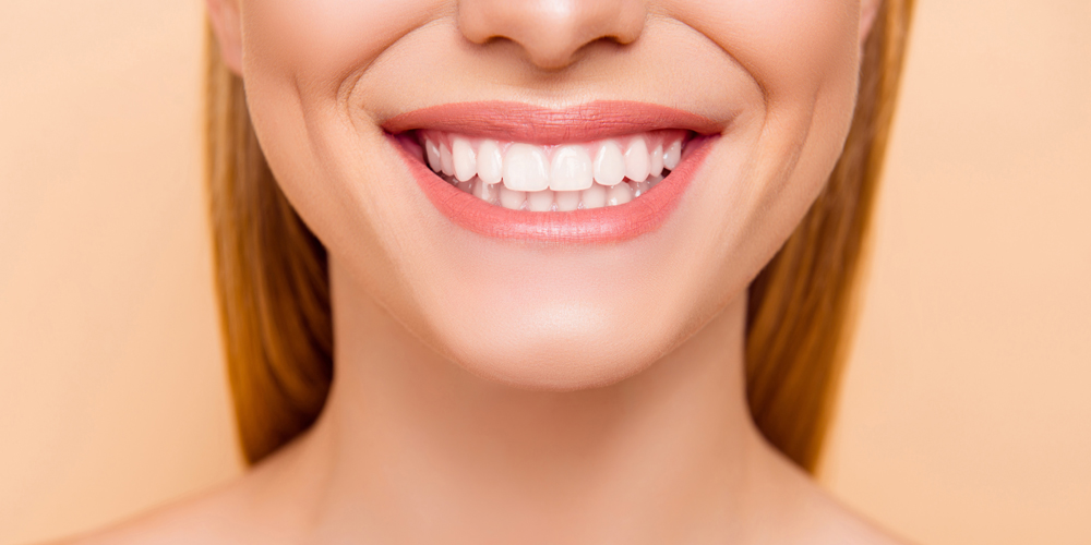 A women smiling with perfect teeth after tooth restoration procedures