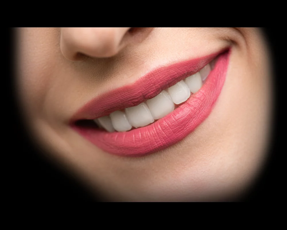 A women smiling after receiving a dental bridge