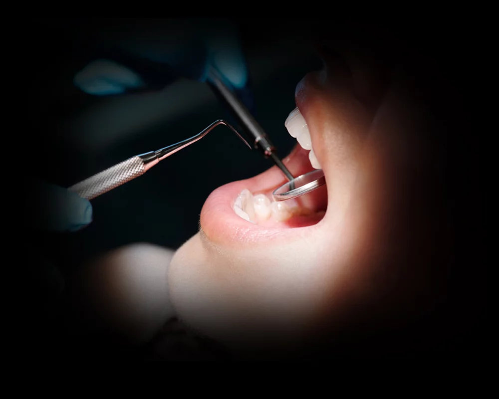 Routine Dental hygiene being performed on a dental patient