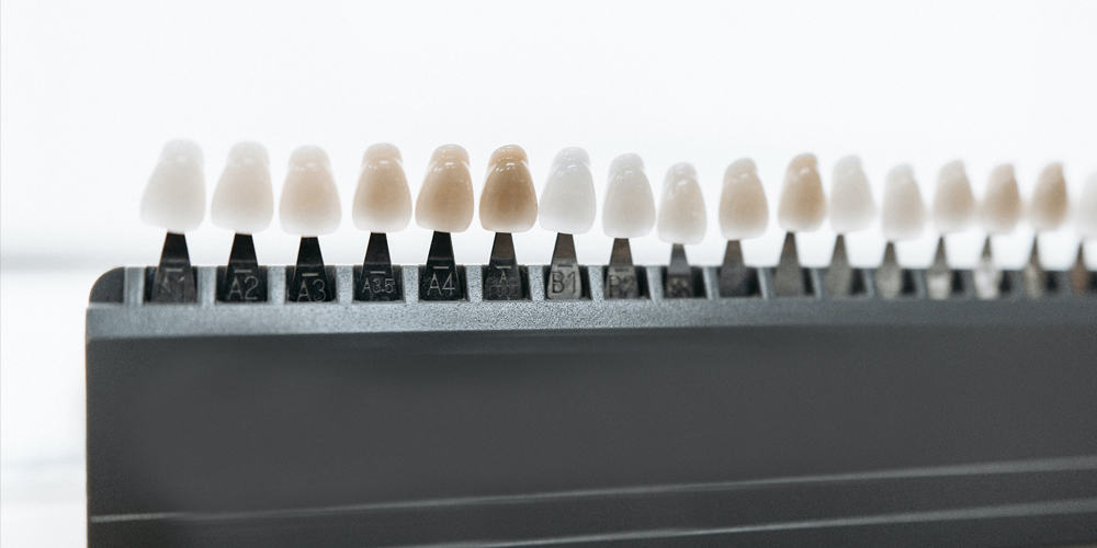 A sample line up of various shades of white for teeth whitening