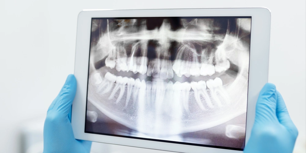 A tablet showing a dental x-ray and how this tool can be utilized to help people