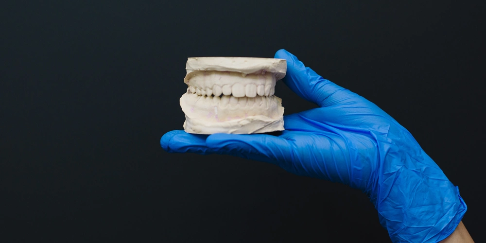 A dentist holding a set of molds for complete dentures